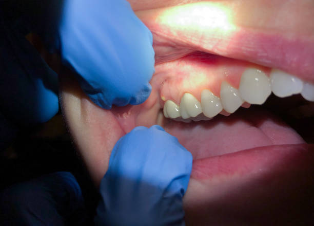 Best Emergency Broken Tooth Repair in The Crossings, FL