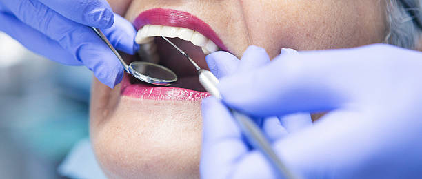 Best Emergency Wisdom Teeth Removal in The Crossings, FL